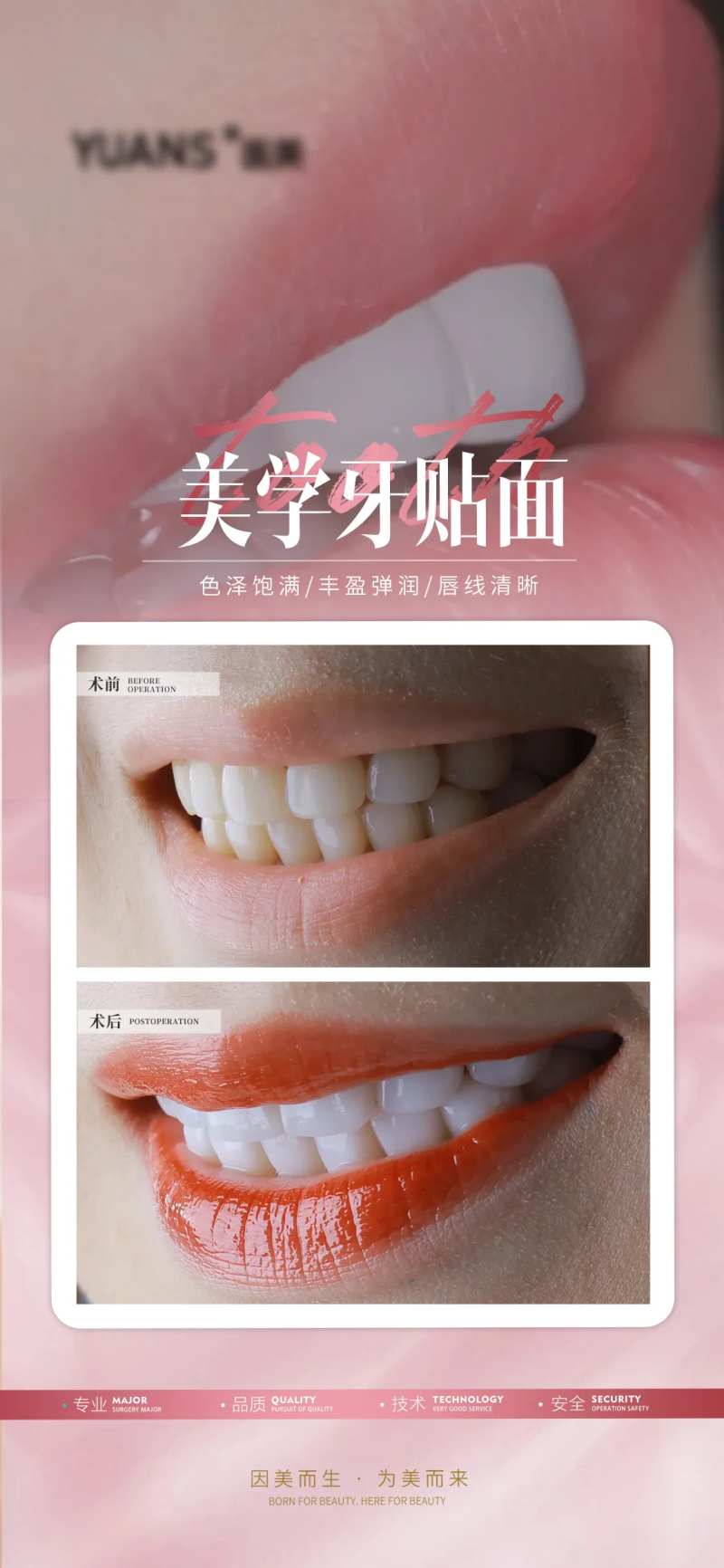 医美牙齿贴面案例海报-采灵感-cailinggan.com