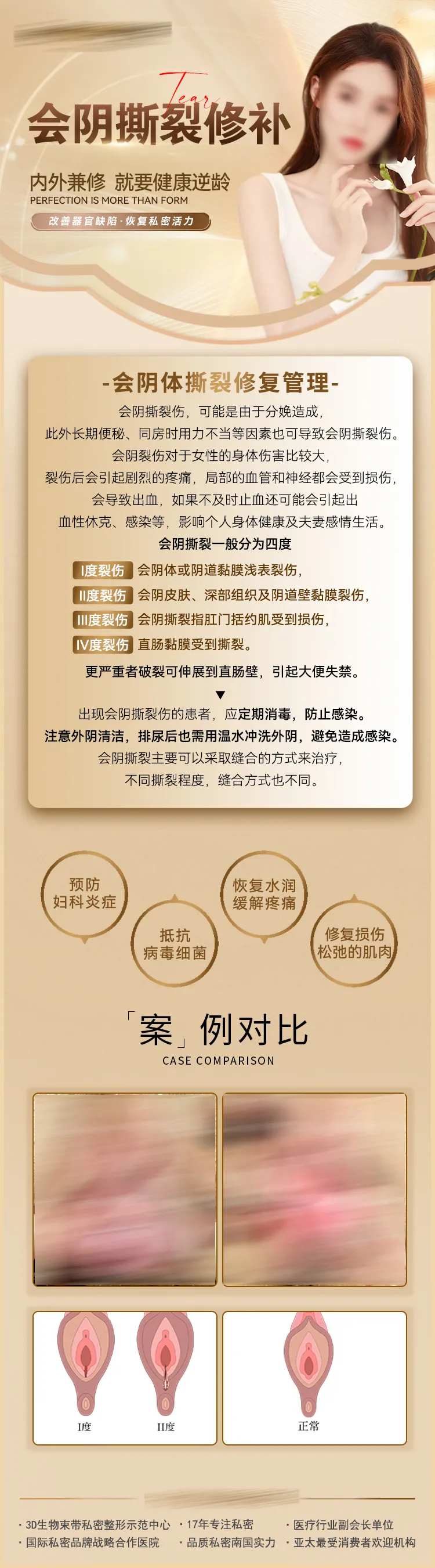 会阴撕裂案例长图-采灵感-cailinggan.com