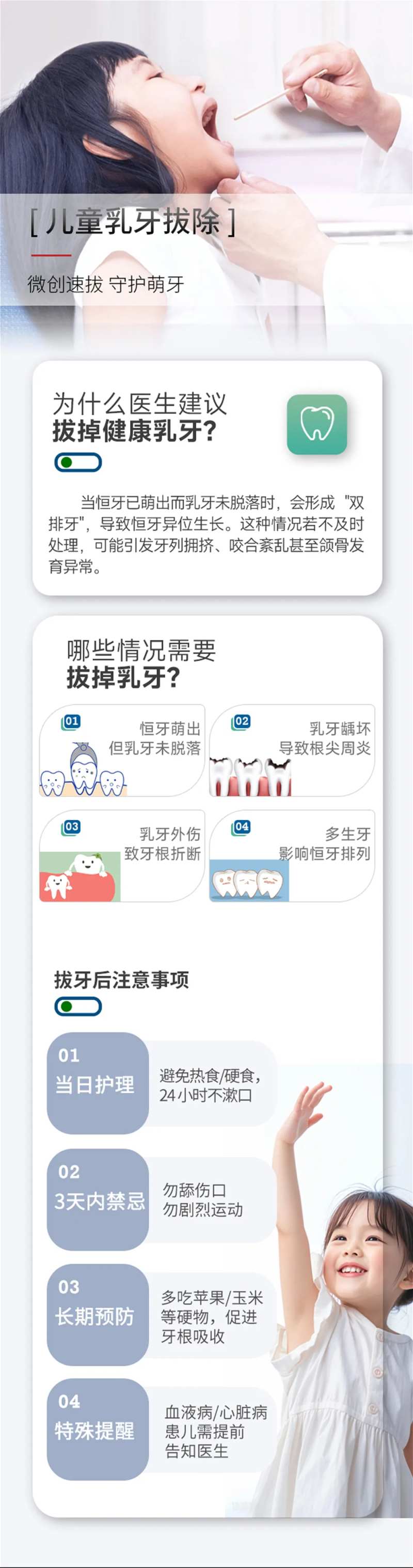 儿童乳牙拔除-采灵感-cailinggan.com