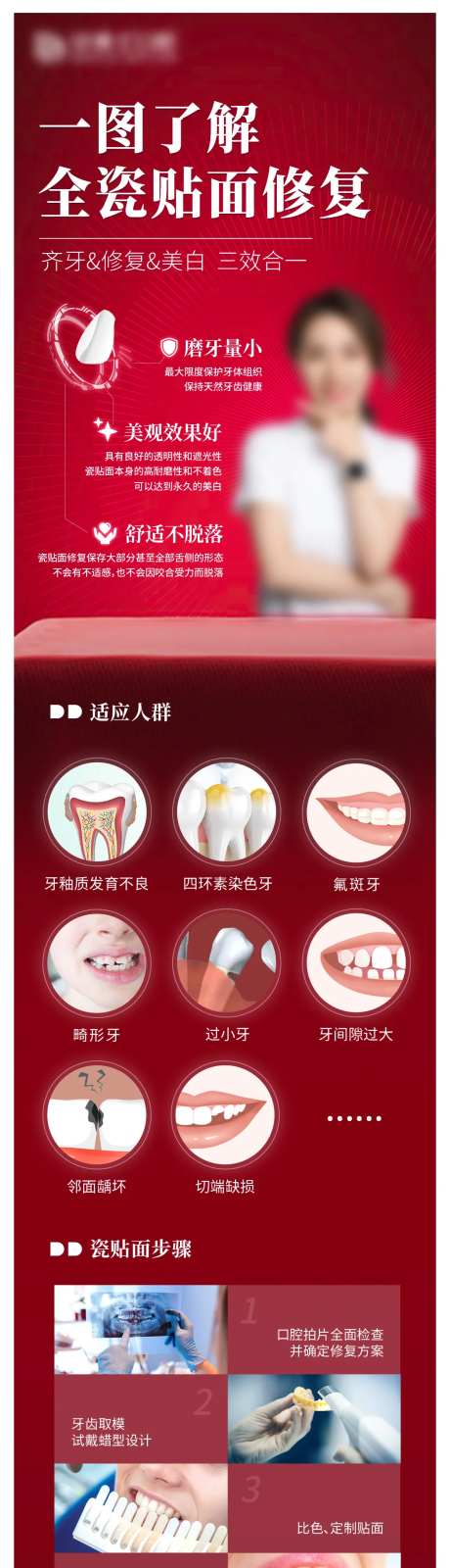  口腔修复瓷贴面详情页-采灵感-https://www.cailinggan.com/