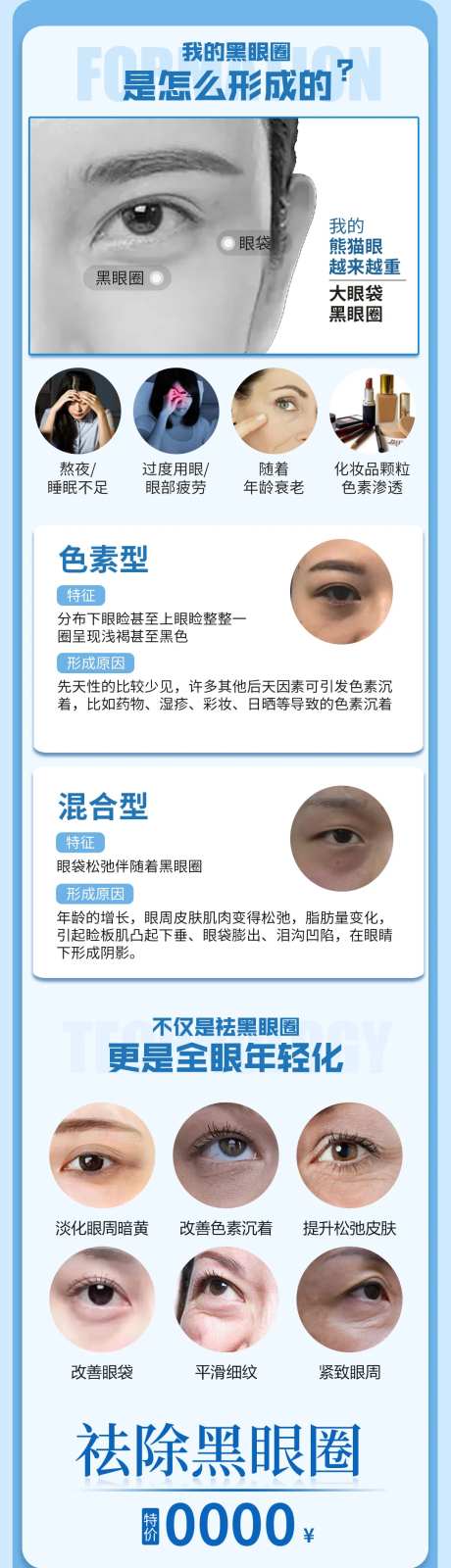 黑眼圈科普长图-采灵感-https://www.cailinggan.com/