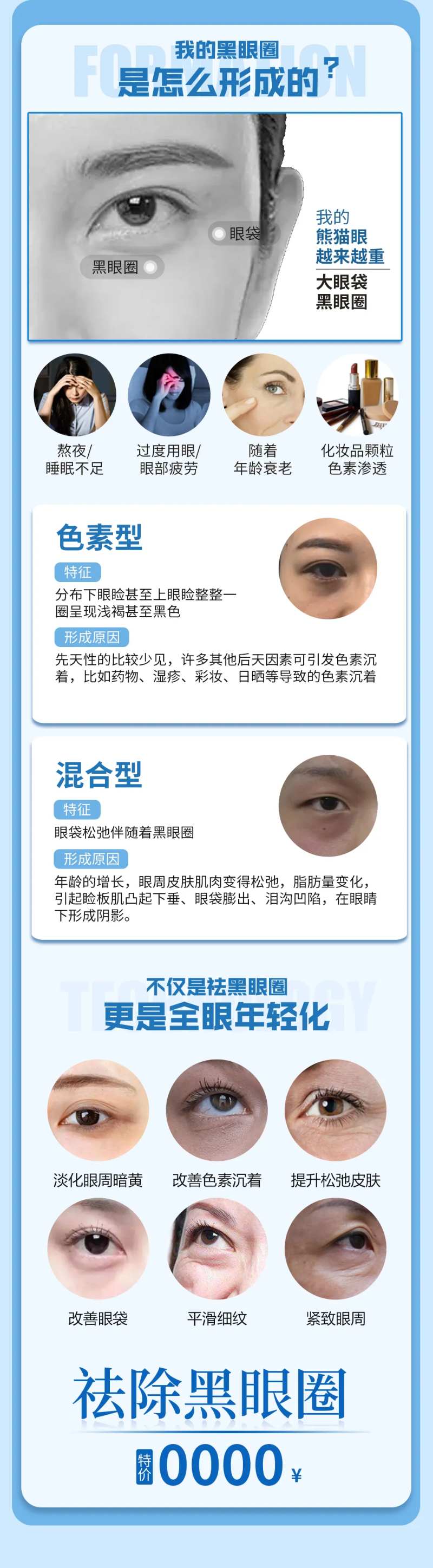 黑眼圈科普长图-采灵感-cailinggan.com