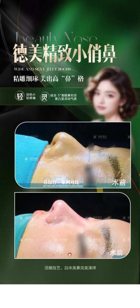 鼻综合案例海报-采灵感-https://www.cailinggan.com/