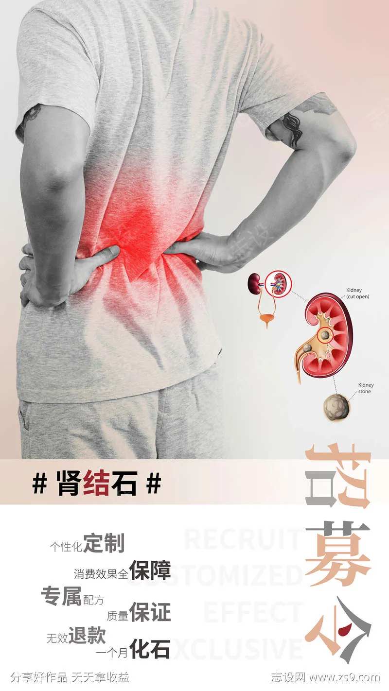 肾结石招募令-采灵感-cailinggan.com