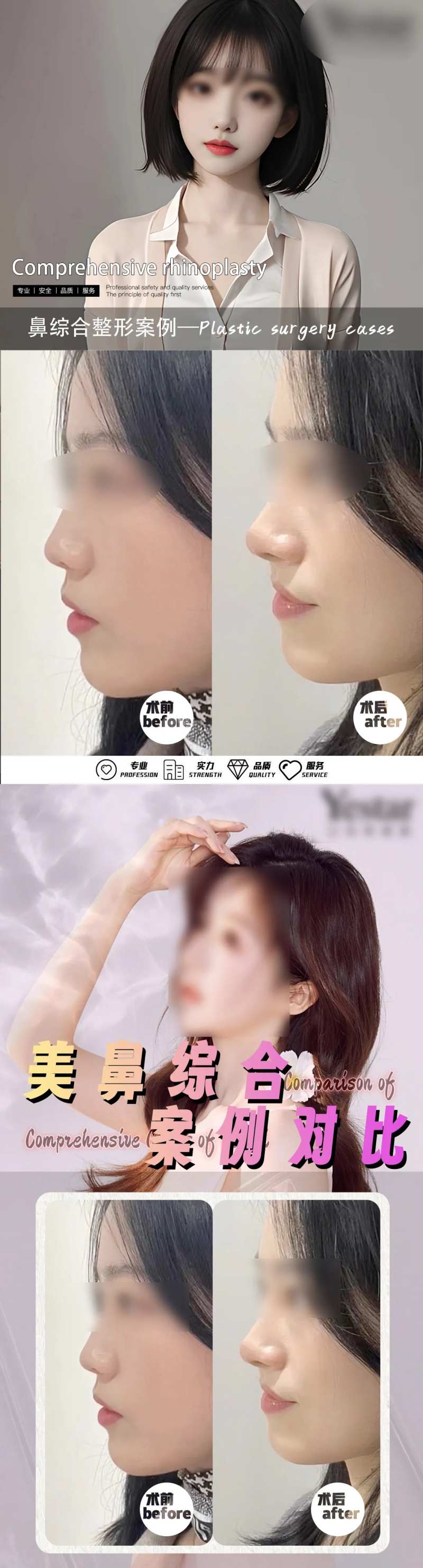 美鼻综合案例系列海报-采灵感-cailinggan.com
