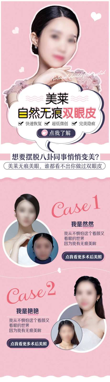 医美自然无痕双眼皮详情页-采灵感-https://www.cailinggan.com/