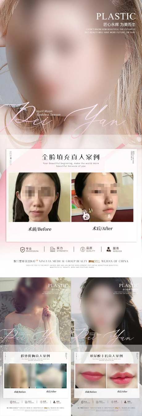 整形案例宣传海报-采灵感-https://www.cailinggan.com/