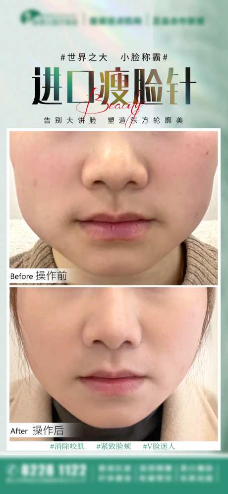 医美案例宣传海报-采灵感-https://www.cailinggan.com/