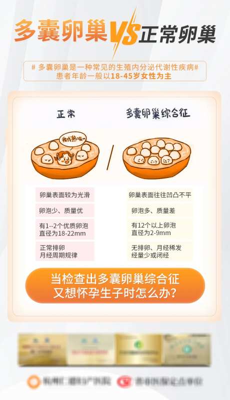 多囊卵巢科普女性海报-采灵感-https://www.cailinggan.com/