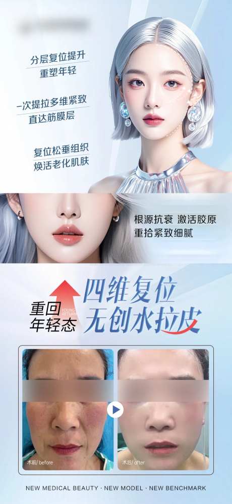 医美全面部拉皮案例海报-采灵感-https://www.cailinggan.com/