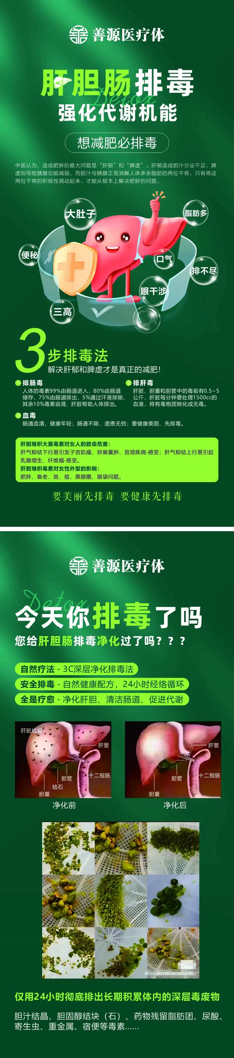 肝胆排毒-采灵感-cailinggan.com