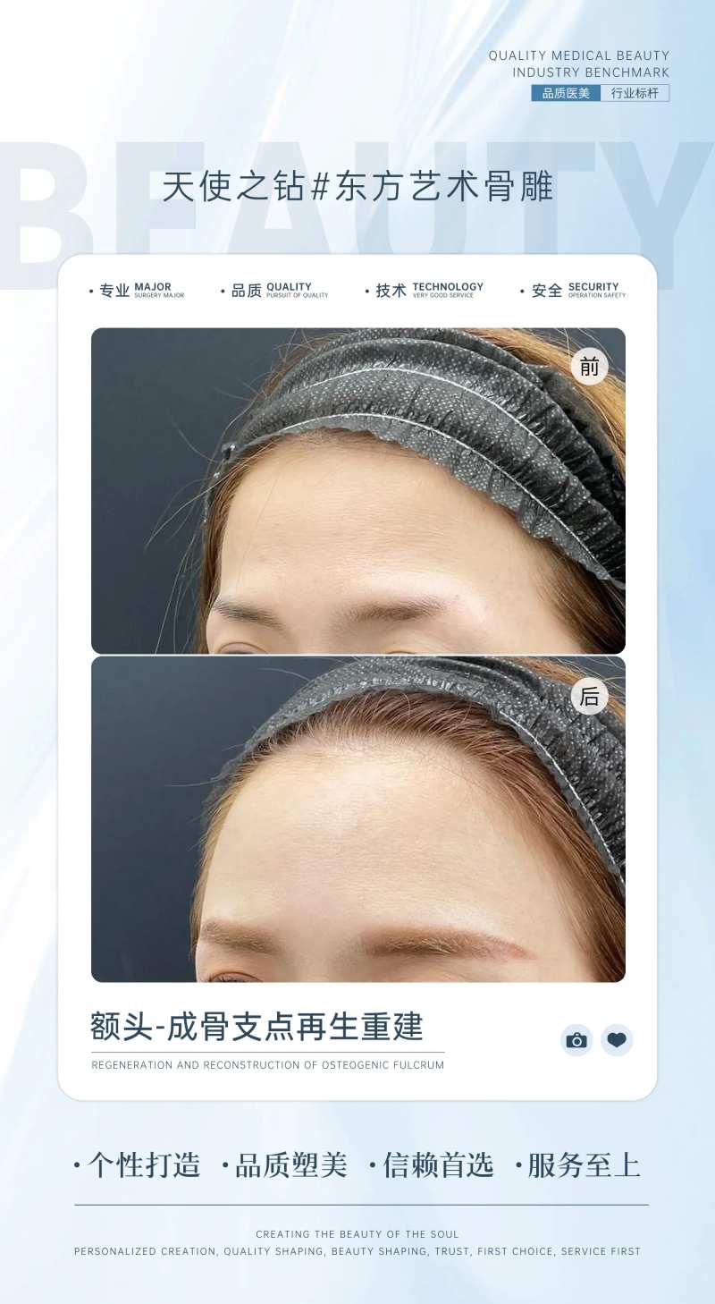 额头填充案例对比海报-采灵感-cailinggan.com