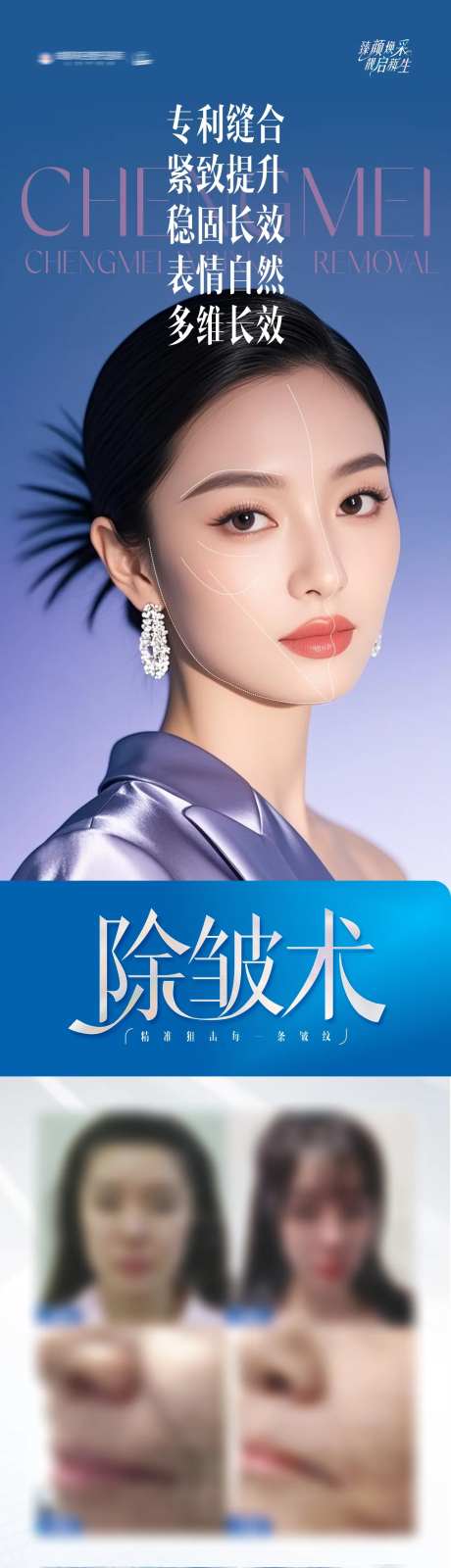 医美除皱术案例长图创意海报-采灵感-https://www.cailinggan.com/