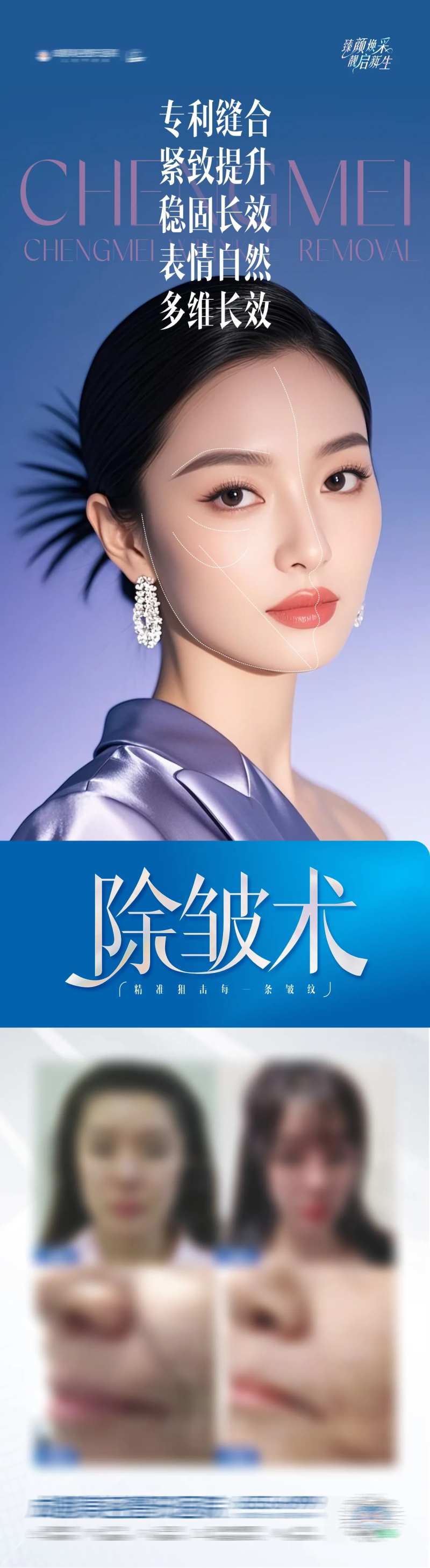 医美除皱术案例长图创意海报-采灵感-cailinggan.com