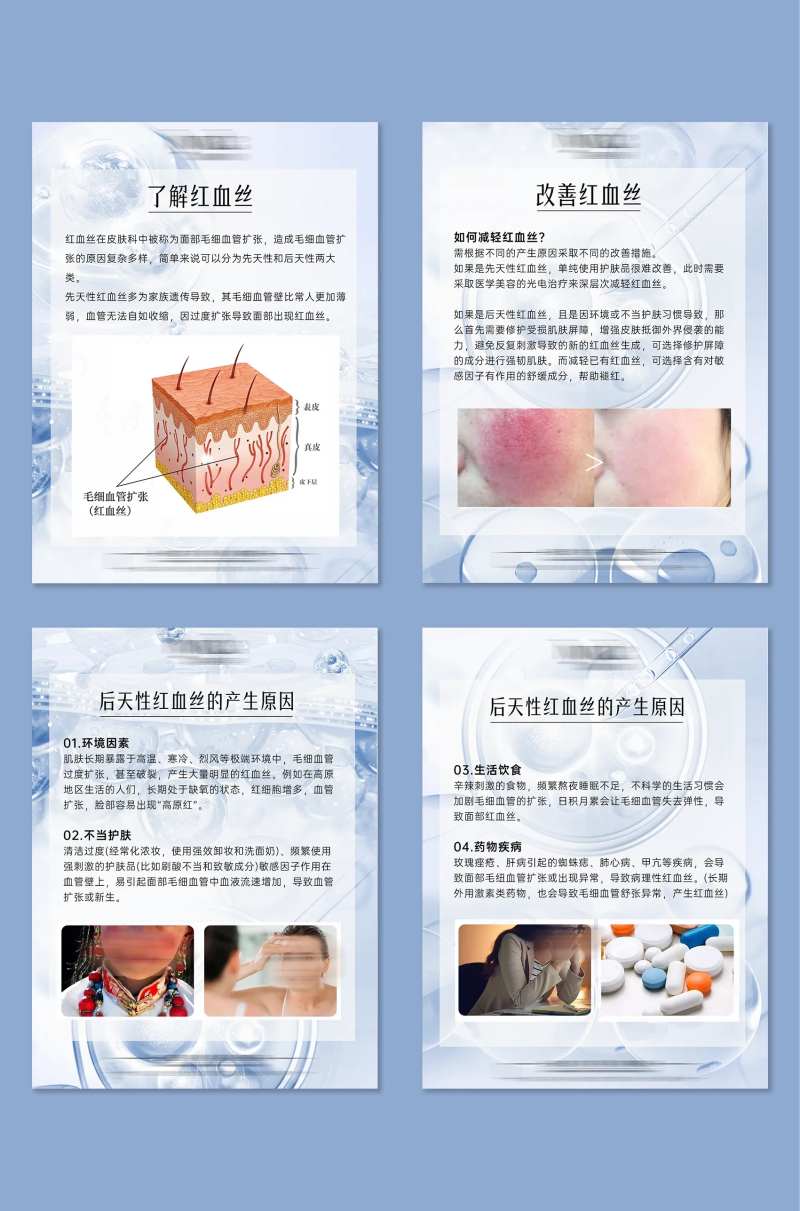 春季敏感了解红血丝小知识系列海报-采灵感-cailinggan.com