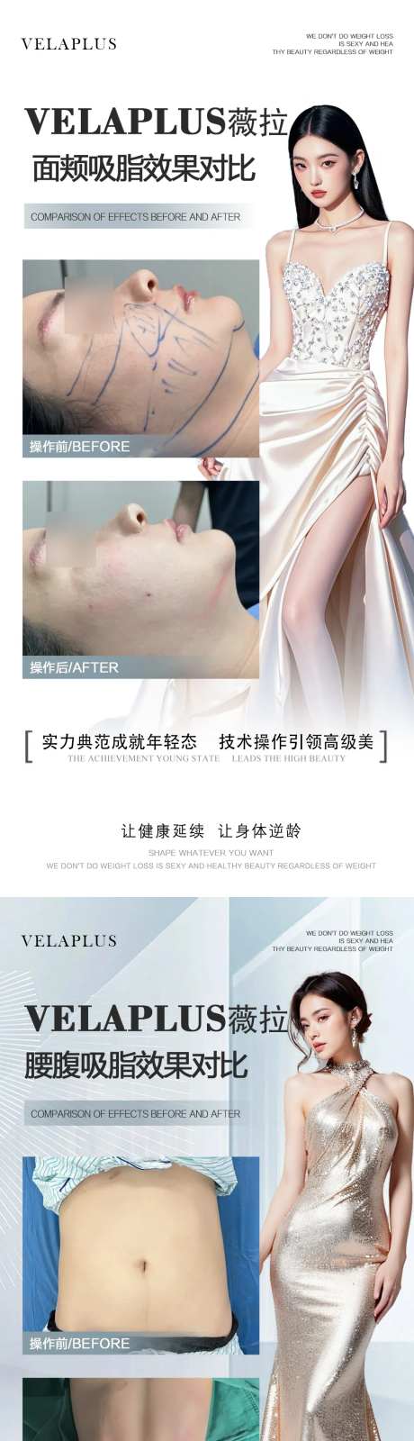 面颊腰腹吸脂案例-采灵感-https://www.cailinggan.com/