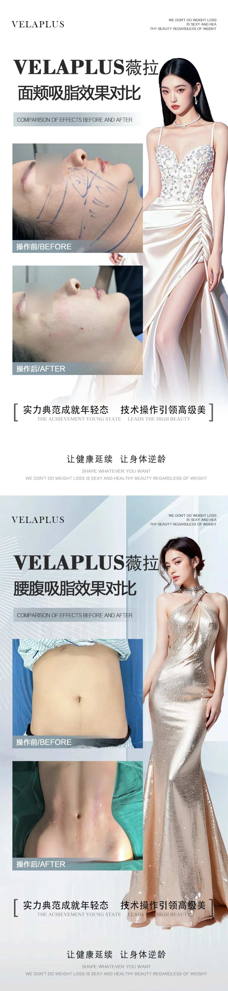 面颊腰腹吸脂案例-采灵感-cailinggan.com