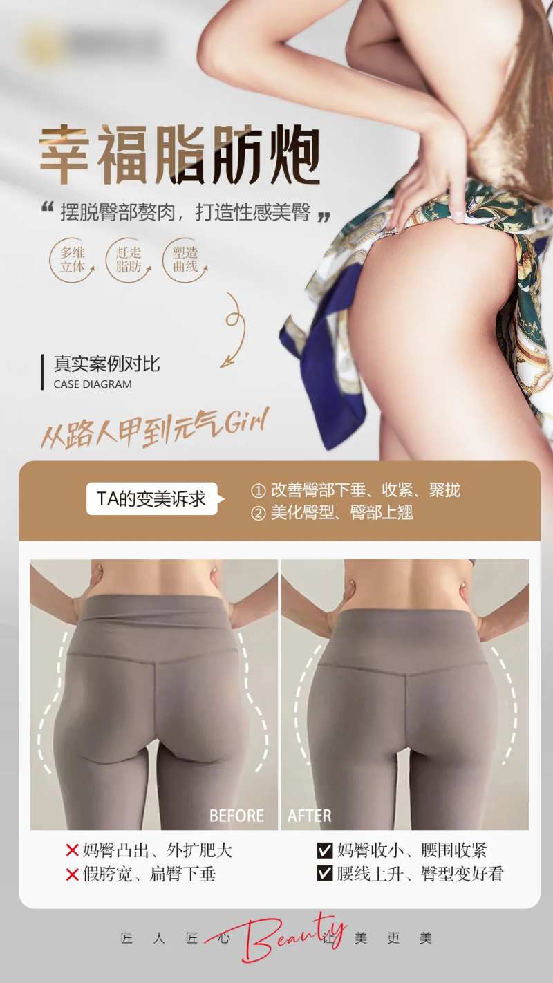 医美臀案例海报-采灵感-cailinggan.com