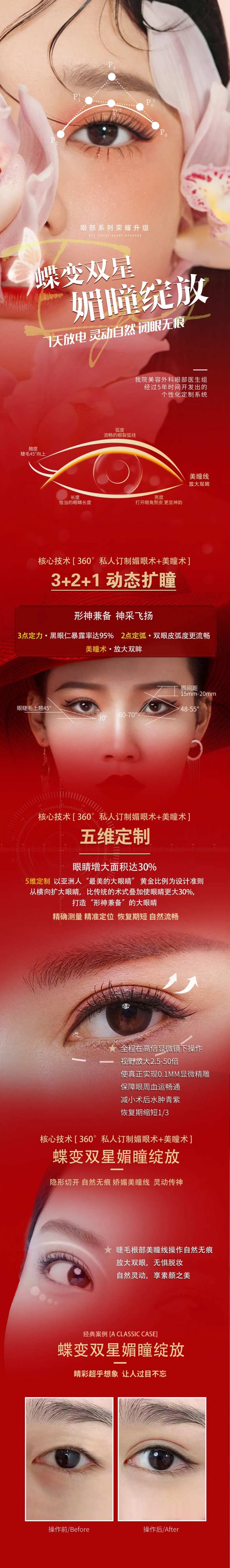 医美 双眼皮详情页-采灵感-cailinggan.com