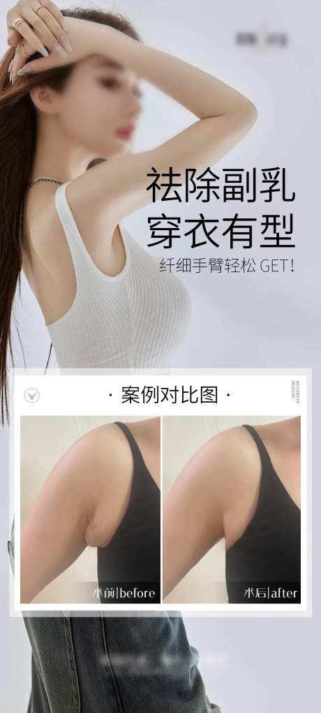 副乳祛除海报-采灵感-https://www.cailinggan.com/