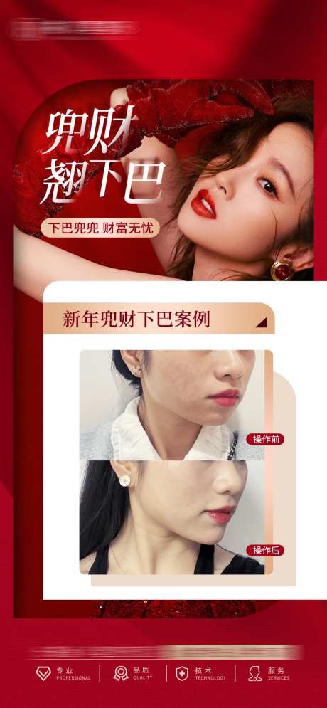 医美丰下巴-采灵感-https://www.cailinggan.com/