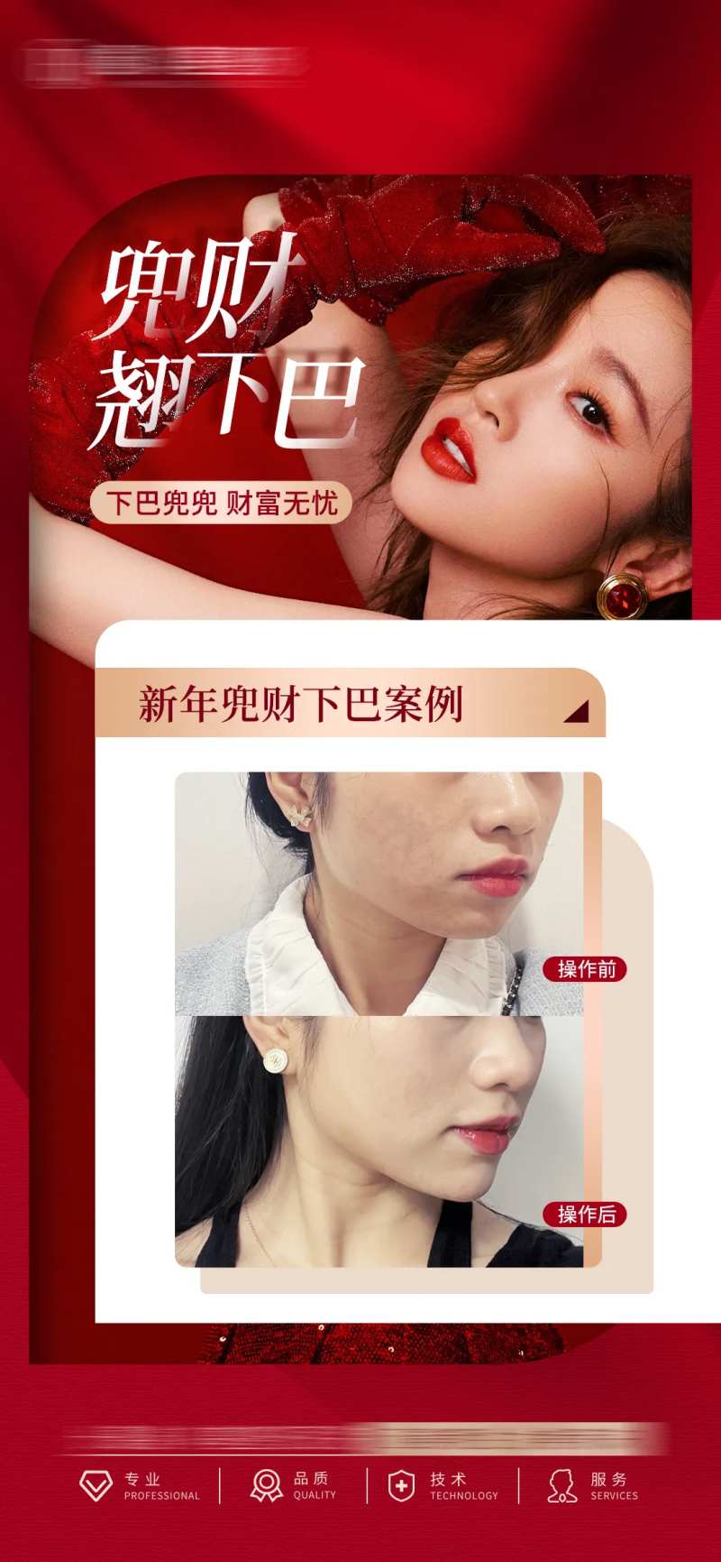 医美丰下巴-采灵感-cailinggan.com