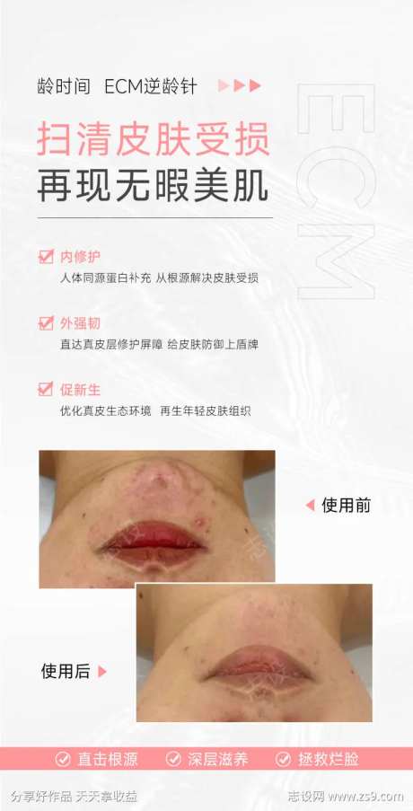 扫清皮肤受损再现无暇美肌-采灵感-https://www.cailinggan.com/