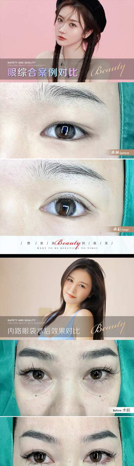 医美案例模板-采灵感-https://www.cailinggan.com/