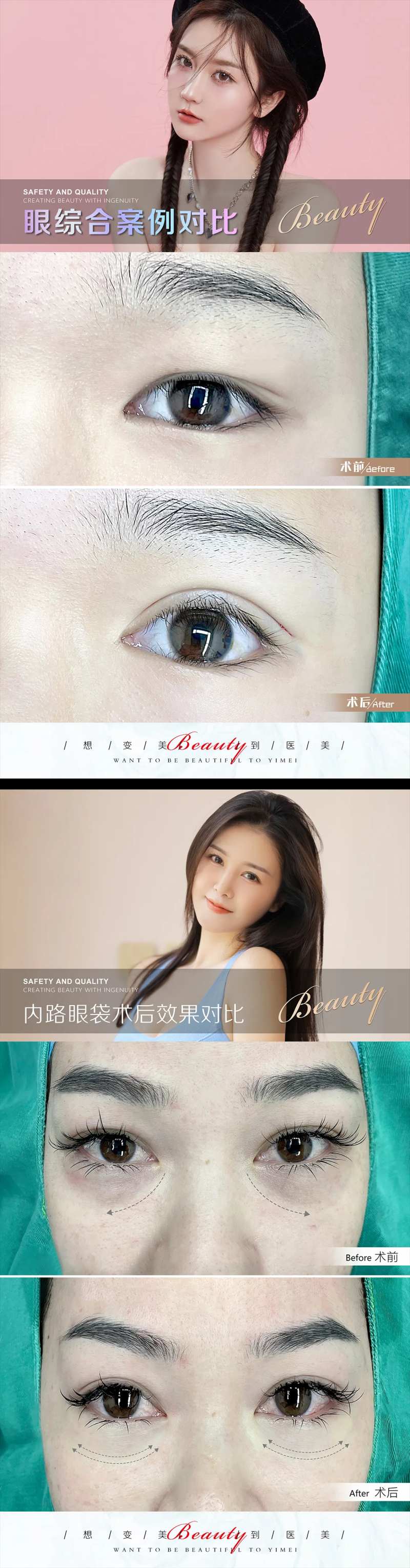 医美案例模板-采灵感-cailinggan.com