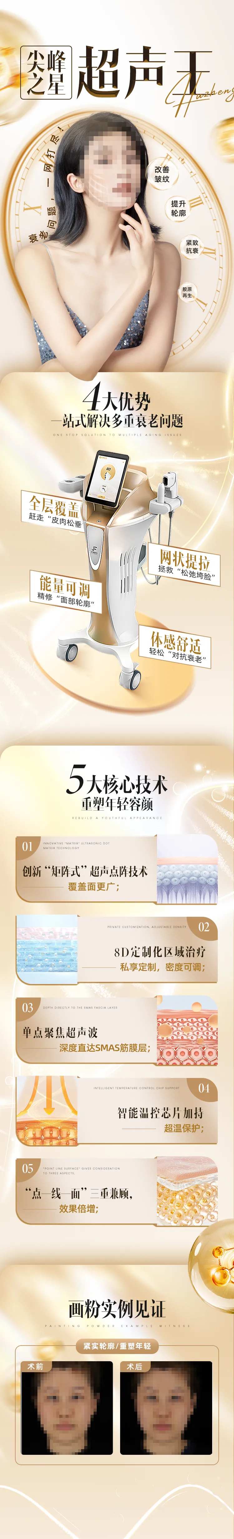 尖峰之星超声王-采灵感-cailinggan.com