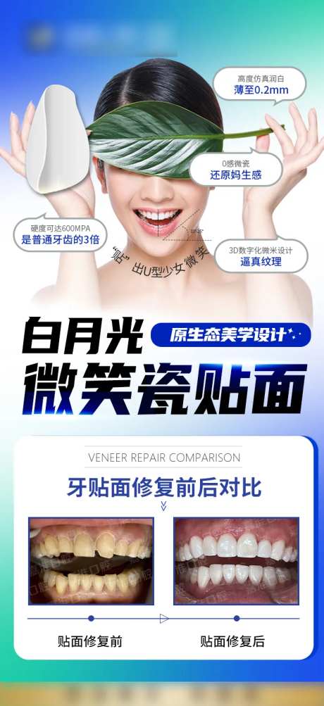 白月光超薄瓷贴面-采灵感-https://www.cailinggan.com/
