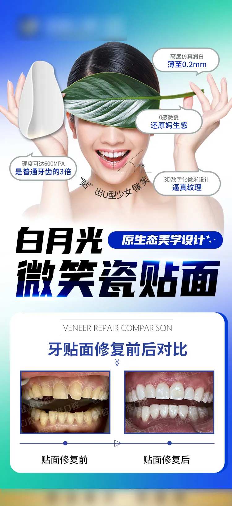 白月光超薄瓷贴面-采灵感-cailinggan.com