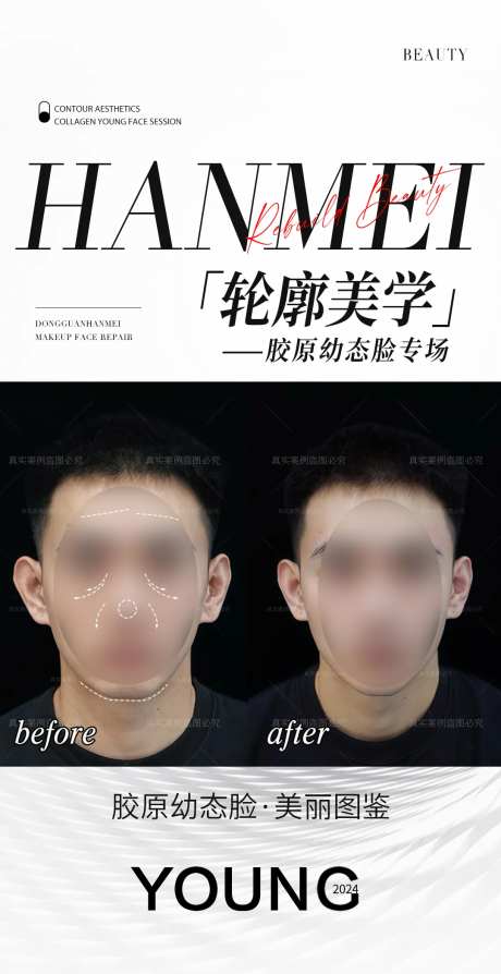 轮廓美学胶原幼态脸-采灵感-https://www.cailinggan.com/