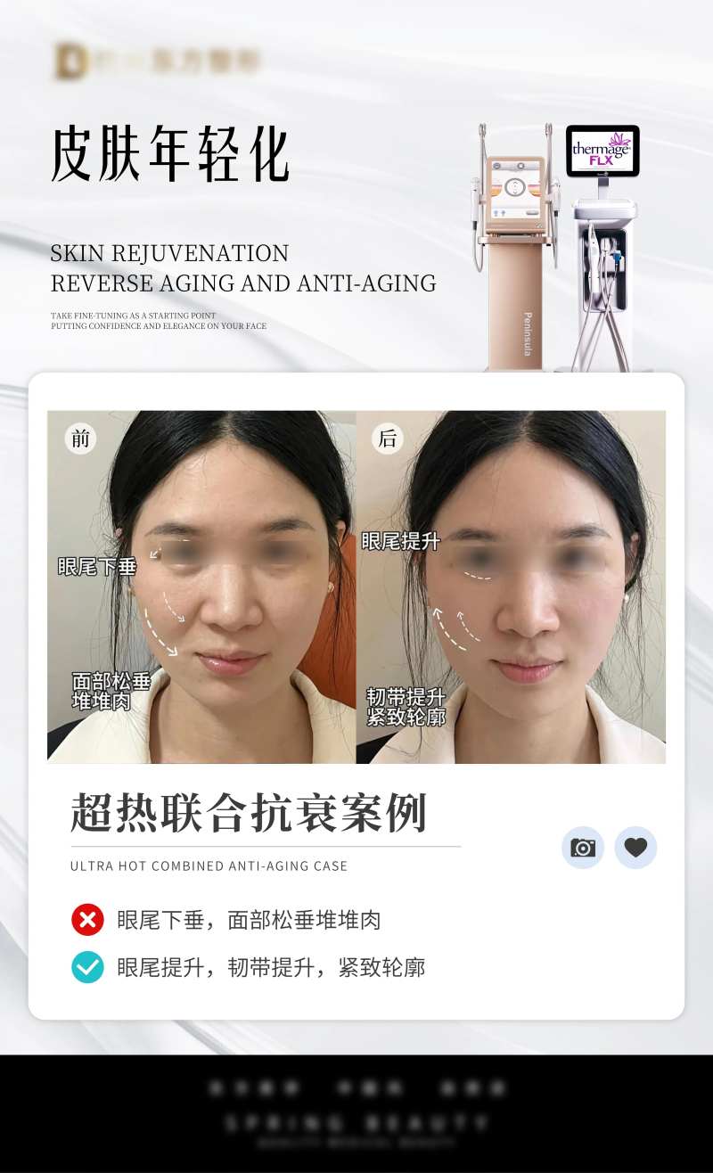 超热联合案例-采灵感-cailinggan.com