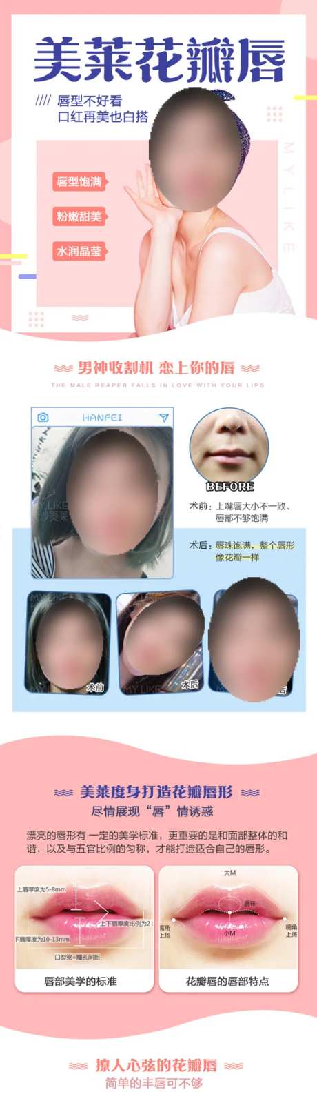 医美花瓣唇详情页-采灵感-https://www.cailinggan.com/