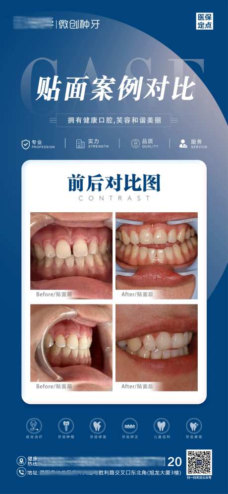 贴面案例对比图-采灵感-https://www.cailinggan.com/