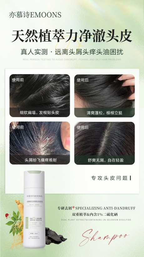 洗发乳头皮去屑对比海报-采灵感-https://www.cailinggan.com/