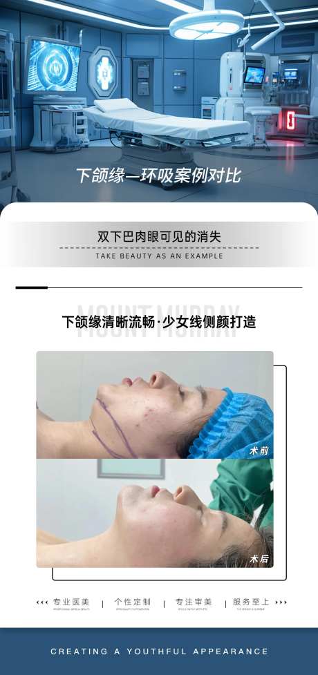 医美下颌缘吸脂案例对比-采灵感-https://www.cailinggan.com/