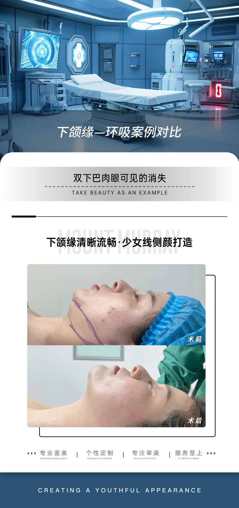 医美下颌缘吸脂案例对比-采灵感-cailinggan.com