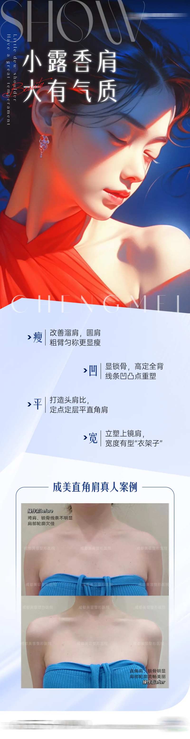 医美直角肩案例海报-采灵感-cailinggan.com