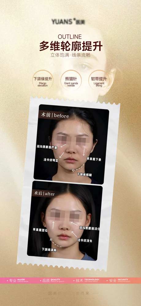 轮廓提升对比案例-采灵感-https://www.cailinggan.com/