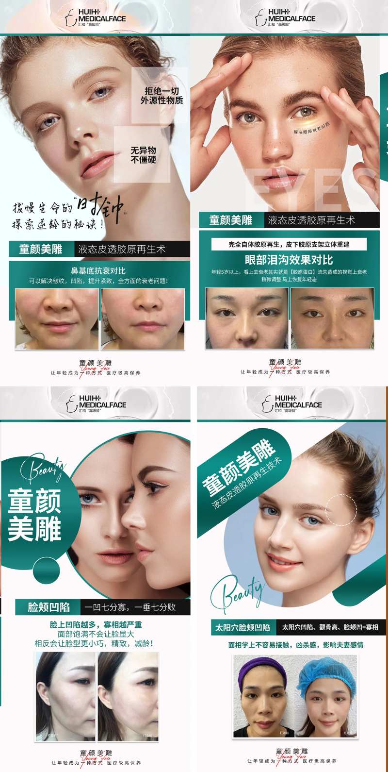 医美童颜美雕系列海报-采灵感-cailinggan.com