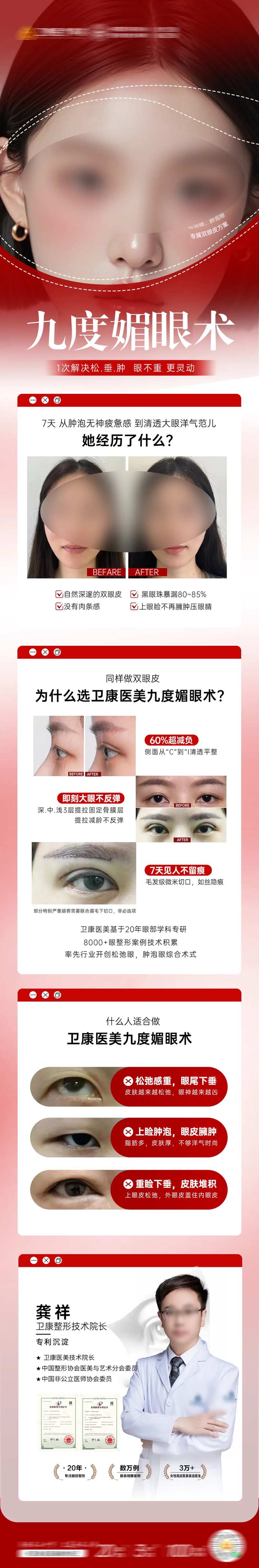 双眼皮 九度媚眼术-采灵感-cailinggan.com