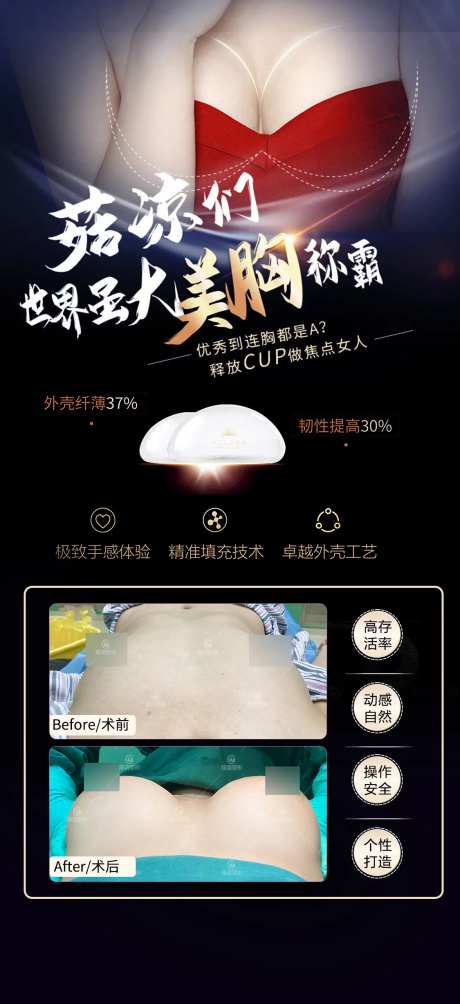 胸整形案例-采灵感-https://www.cailinggan.com/