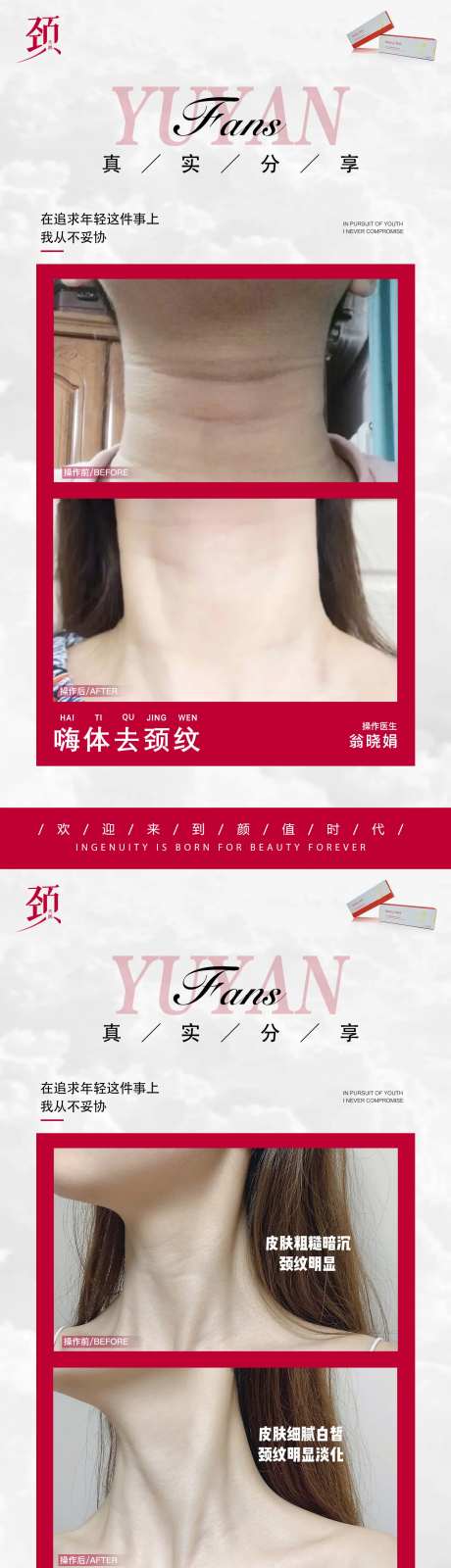 医美颈纹案例海报-采灵感-https://www.cailinggan.com/