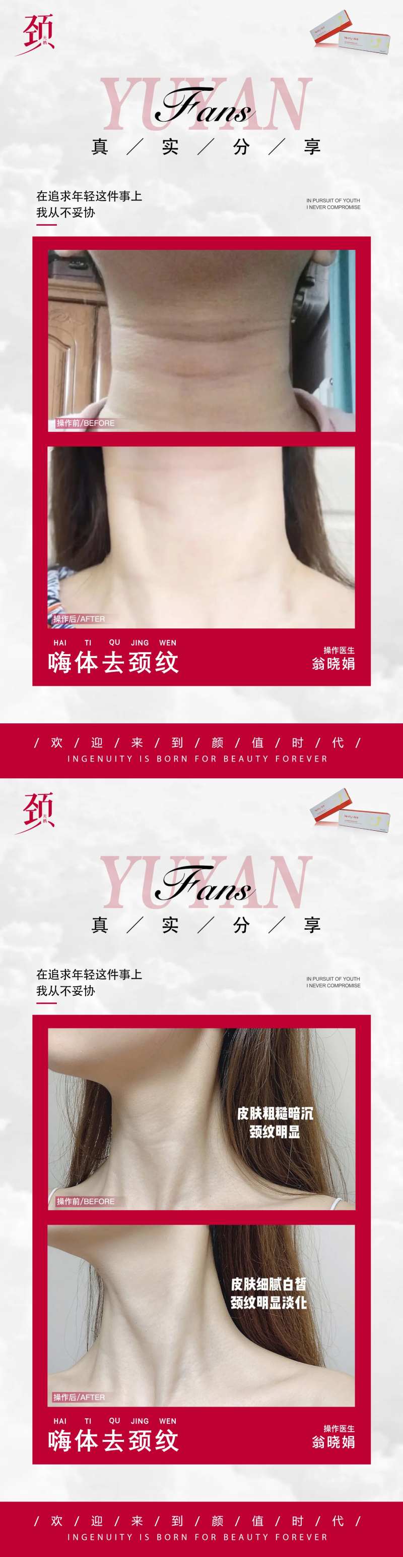 医美颈纹案例海报-采灵感-cailinggan.com