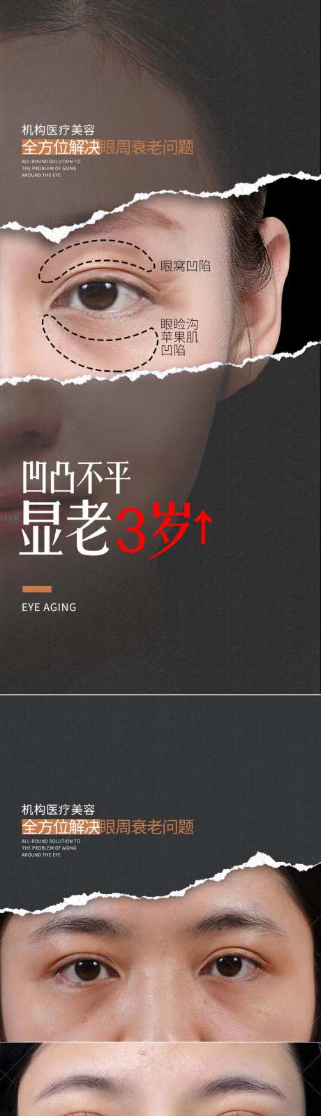 医美眼部年轻化海报-采灵感-https://www.cailinggan.com/