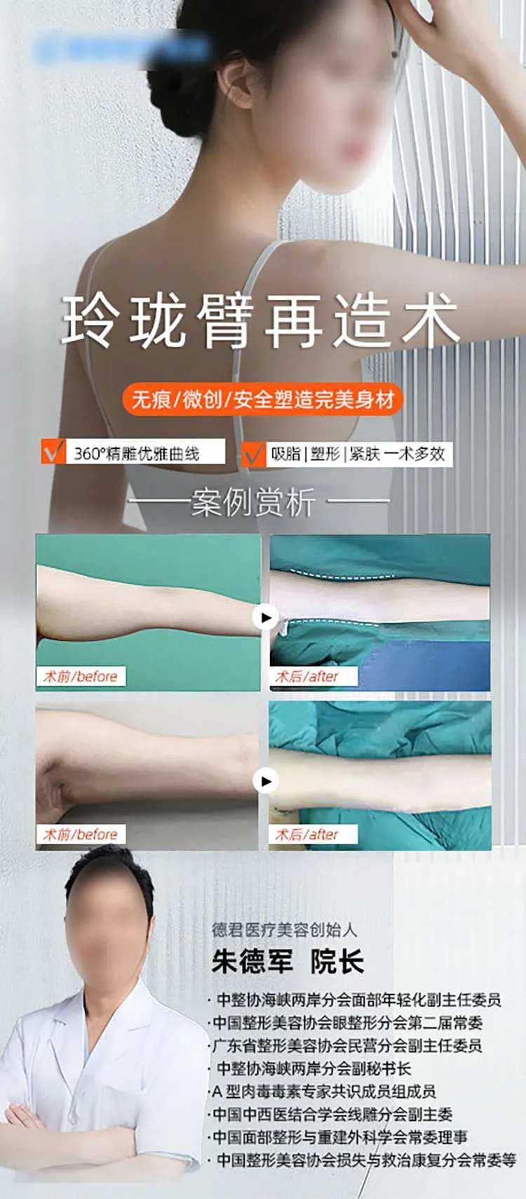 手臂吸脂-采灵感-cailinggan.com