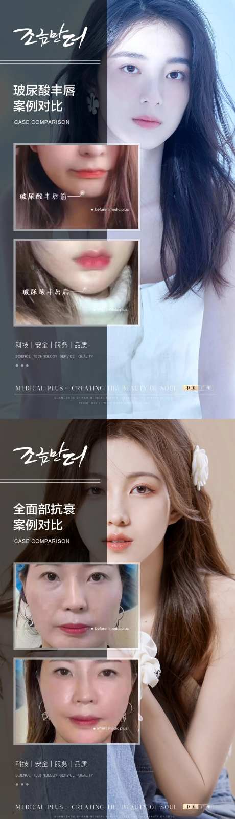 整形真人案例分享集-采灵感-https://www.cailinggan.com/