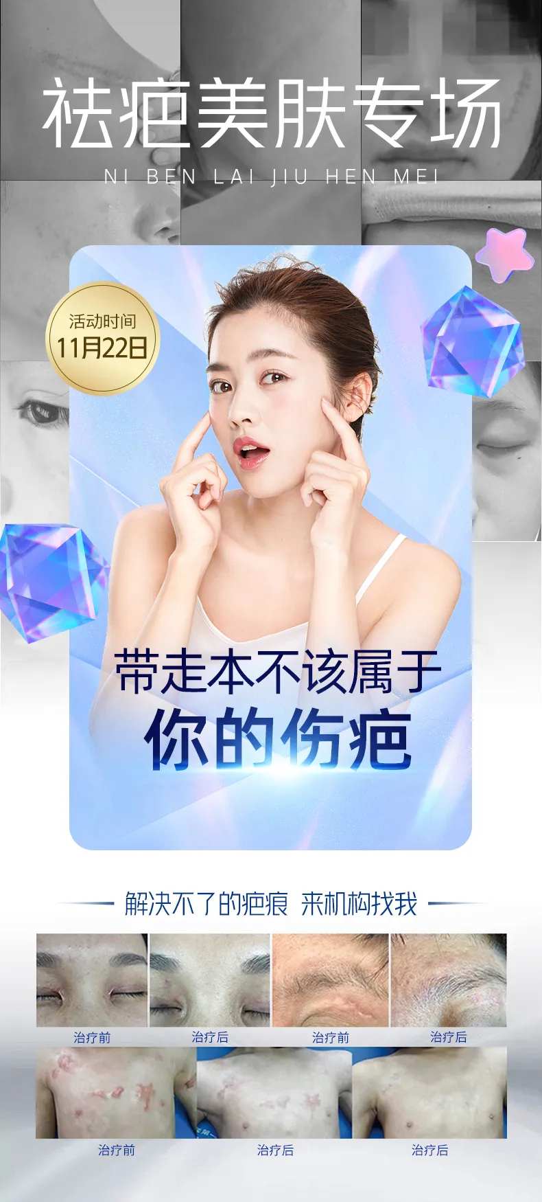 祛疤美肤-采灵感-cailinggan.com